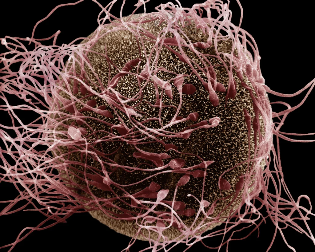 sperm cells surrounding a human egg, illustrating the process of fertilization.